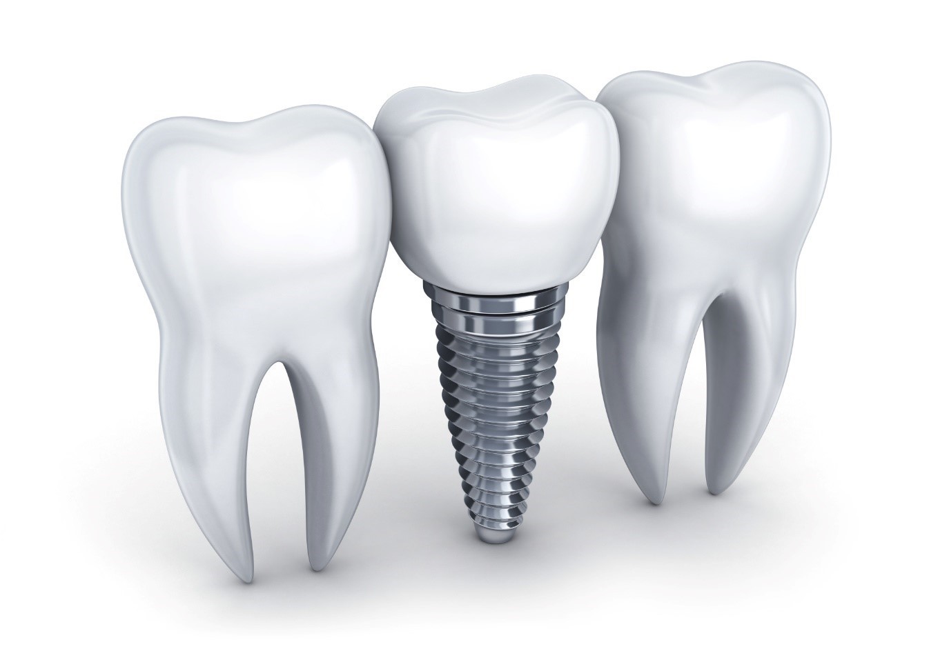 پایه فلزی ایمپلنت دندانی